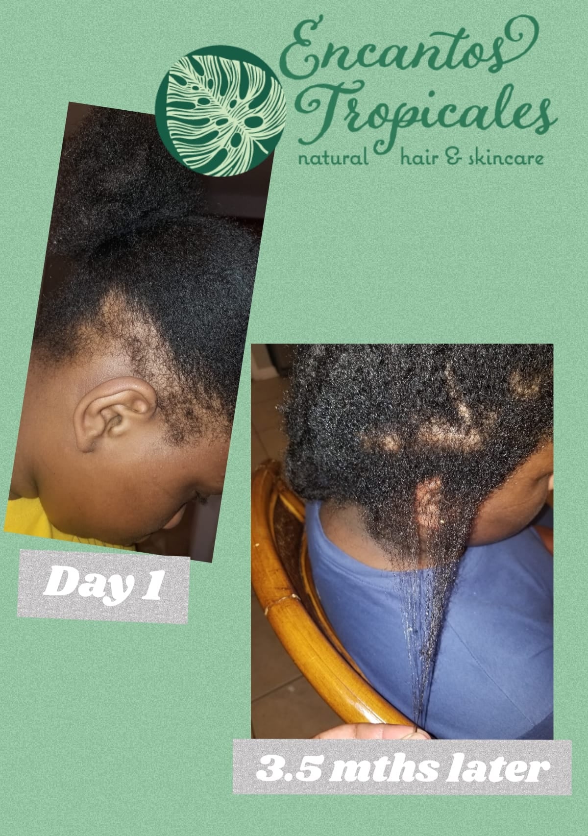 Growth & Anti-Inflammatory Hair Oil