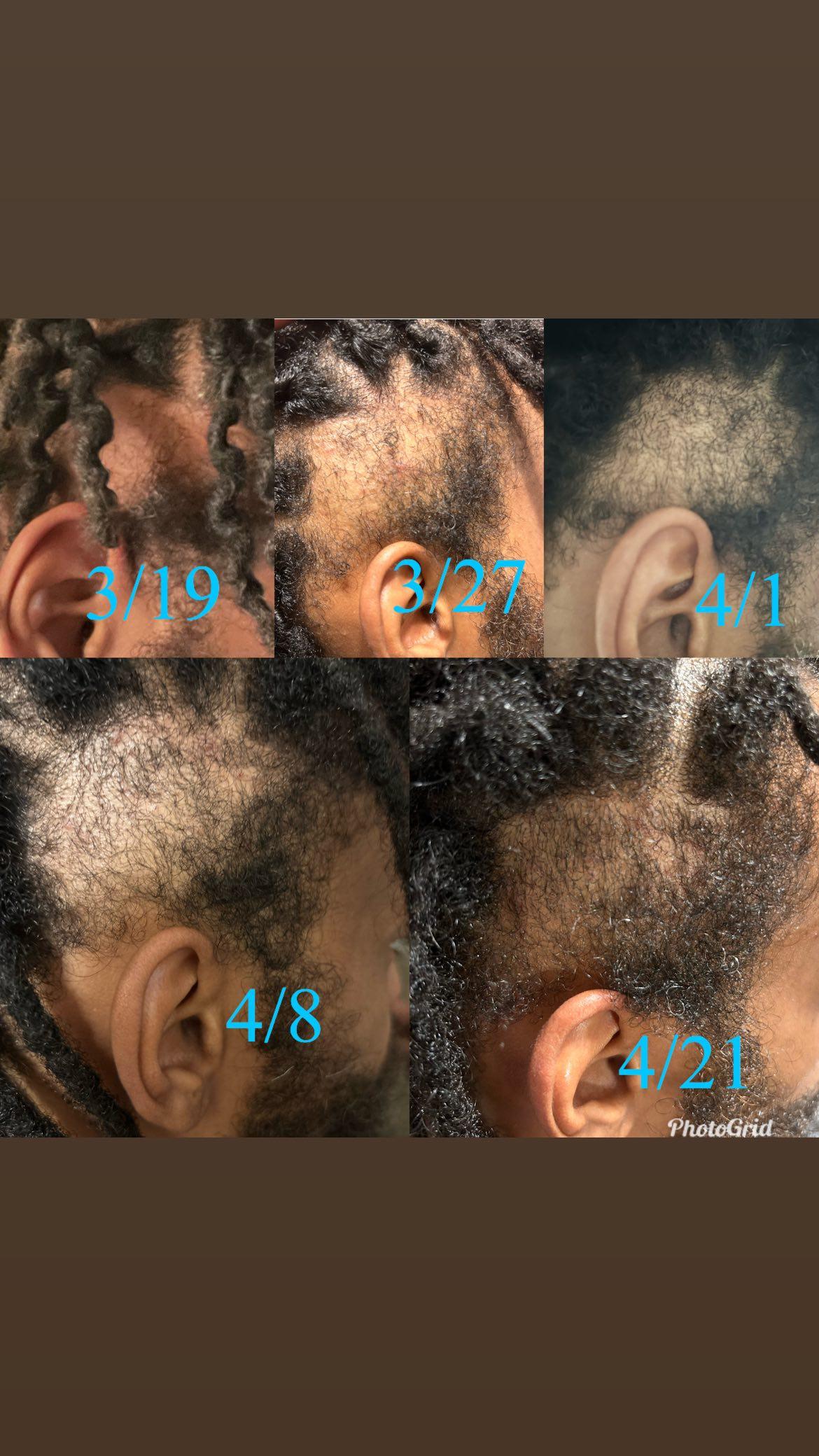 Growth & Anti-Inflammatory Hair Oil