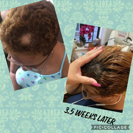 Growth & Anti-Inflammatory Hair Oil
