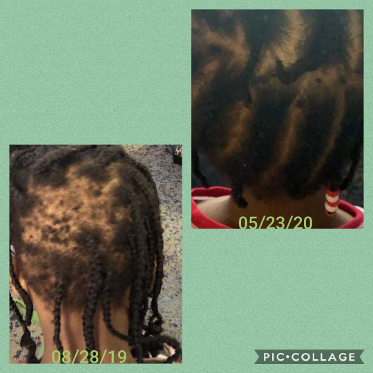 Growth & Anti-Inflammatory Hair Oil
